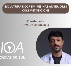 Escultura e cor em resinas anteriores com método one