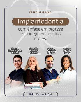 Implantodontia com Ênfase em Prótese sobre Implantes e Manejo em Tecidos Moles