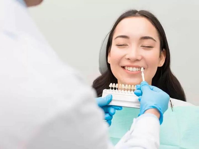 Conheça os benefícios da lente de contato dental